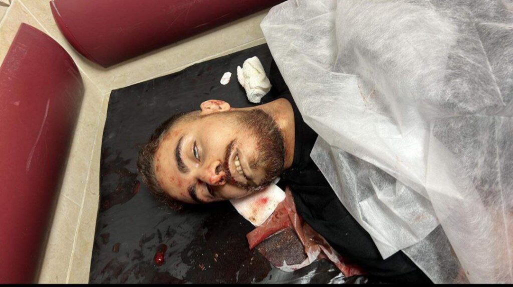 🛑 استشهاد الشاب يزن اشتيه من قرية تل جنوب غرب مدينة نابلس