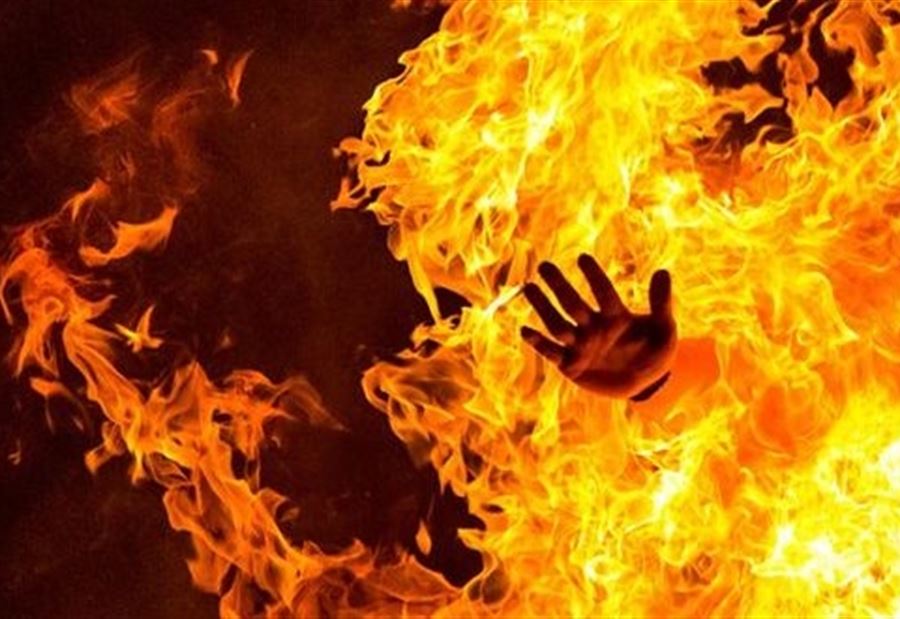 أحرقها صديقها وهي حية.. وهذا ما حصل معها 3 أحرقها صديقها وهي حية.. وهذا ما حصل معها