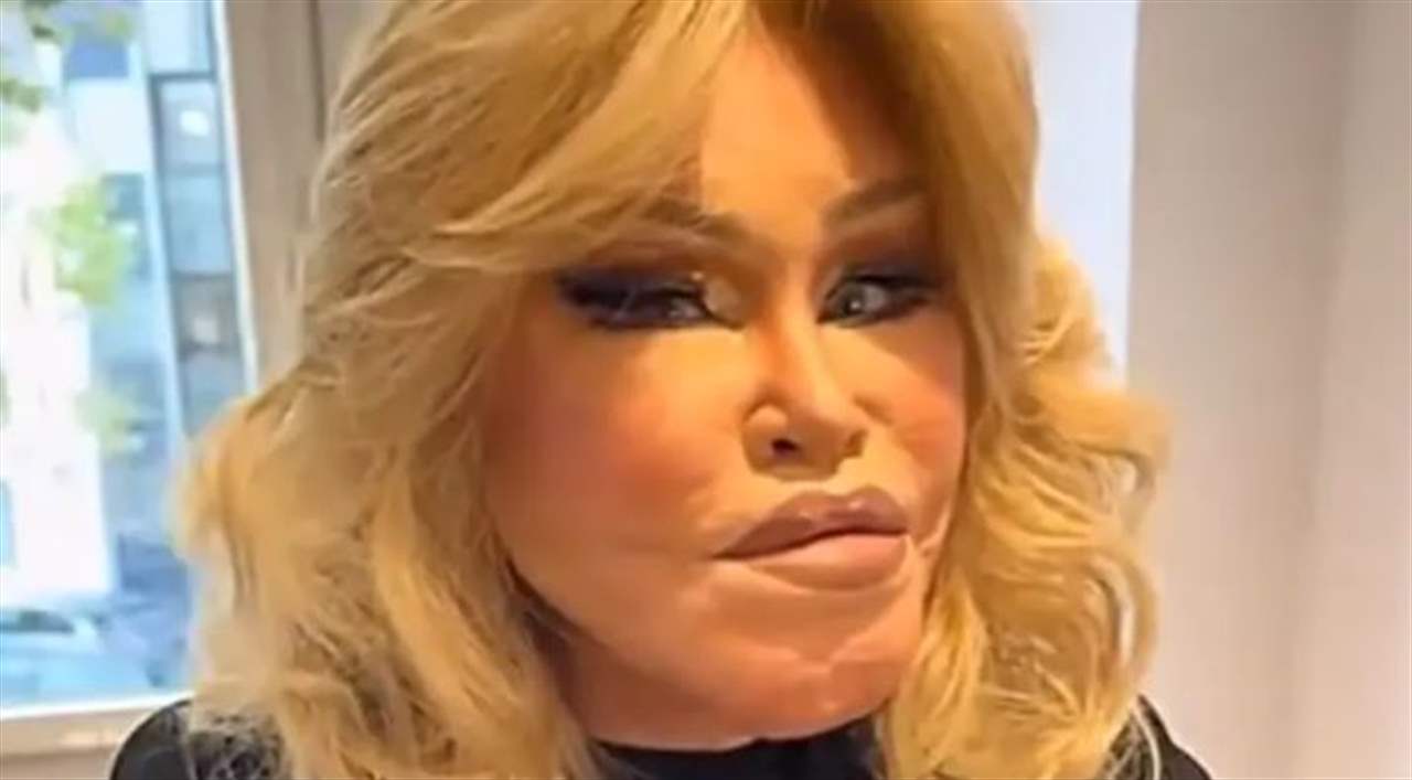 توفيت في اليوم الأخير من العام 2024 أثناء نومها.. من هي "المرأة القطة"؟ (فيديو) 3 توفيت في اليوم الأخير من العام 2024 أثناء نومها.. من هي "المرأة القطة"؟ (فيديو)