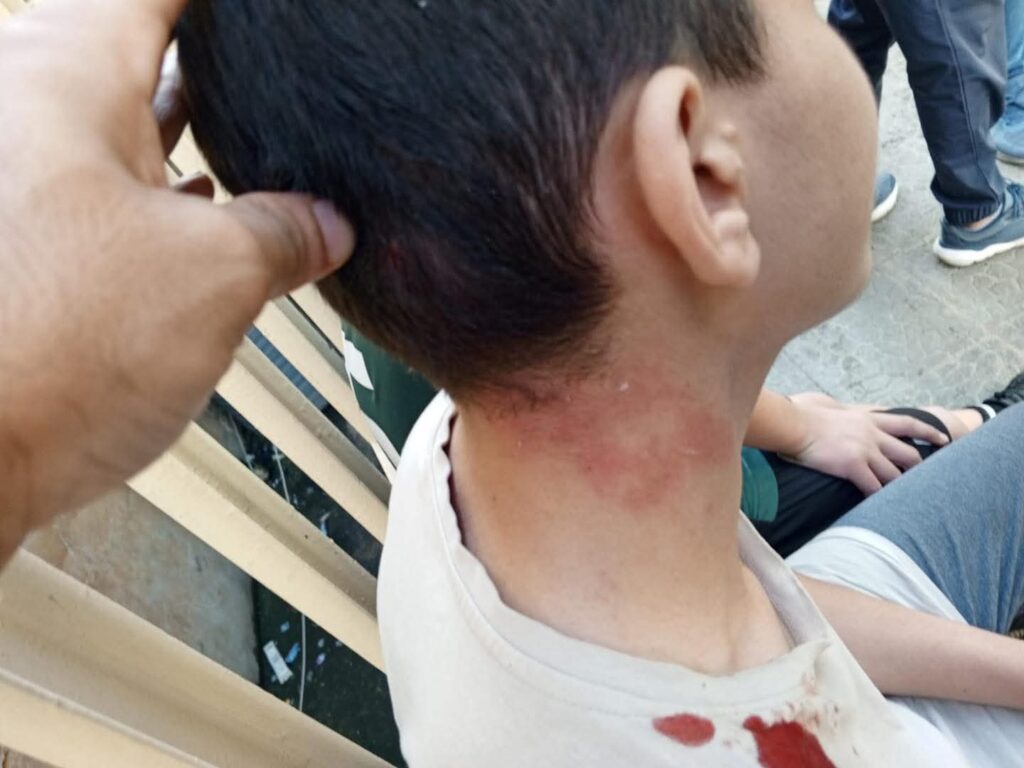 إصابة طفلين جراء سقوط حجارة من شرفة منزل متصدّع في طرابلس