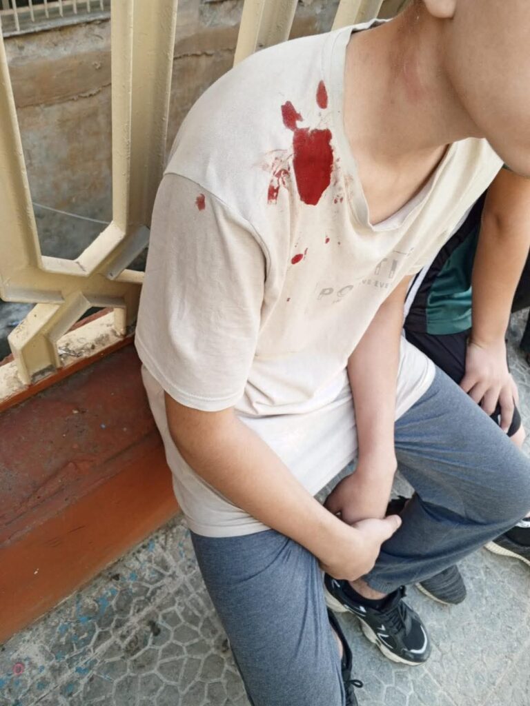 إصابة طفلين جراء سقوط حجارة من شرفة منزل متصدّع في طرابلس 1 إصابة طفلين جراء سقوط حجارة من شرفة منزل متصدّع في طرابلس
